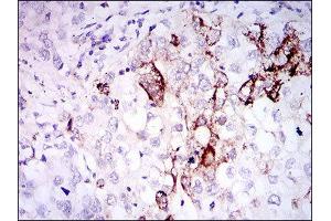 Immunohistochemistry (IHC) image for anti-Somatostatin (SST) (AA 1-116) antibody (ABIN1845358) (Somatostatin antibody  (AA 1-116))