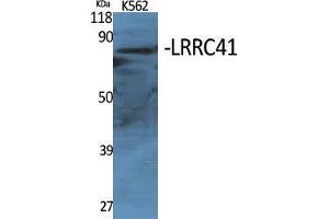 Western Blot (WB) analysis of specific cells using LRRC41 Polyclonal Antibody. (LRRC41 antibody  (Internal Region))