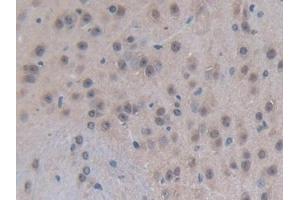 Detection of EP300 in Mouse Brain Tissue using Polyclonal Antibody to E1A Binding Protein P300 (EP300) (p300 antibody  (AA 2124-2397))