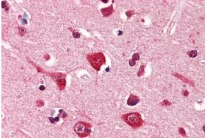 Human Brain, Cortex (formalin-fixed, paraffin-embedded) stained with PDPN antibody ABIN364350 at 5 ug/ml followed by biotinylated anti-mouse IgG secondary antibody ABIN481714, alkaline phosphatase-streptavidin and chromogen. (Podoplanin antibody  (AA 1-206))