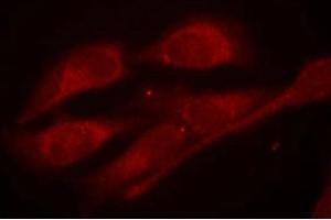 Immunofluorescence staining of methanol-fixed Hela cells using Shc1(Phospho-Tyr427) Antibody. (SHC1 antibody  (pTyr427))