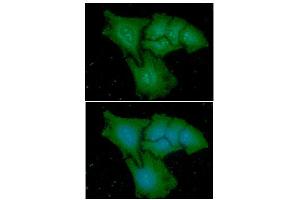 ICC/IF analysis of CAPG in HeLa cells line, stained with DAPI (Blue) for nucleus staining and monoclonal anti-human CAPG antibody (1:100) with goat anti-mouse IgG-Alexa fluor 488 conjugate (Green). (CAPG antibody  (AA 1-348))