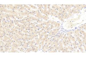 Detection of LAMC3 in Human Liver Tissue using Polyclonal Antibody to Laminin Gamma 3 (LAMC3) (LAMC3 antibody  (AA 901-1100))