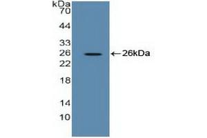 Western blot analysis of recombinant Human EEF2. (EEF2 antibody  (AA 32-233))
