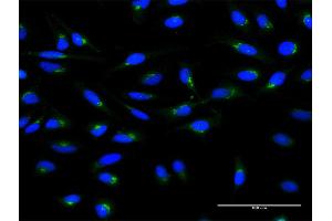 Immunofluorescence of monoclonal antibody to ARF1 on HeLa cell. (ARF1 antibody  (AA 1-181))