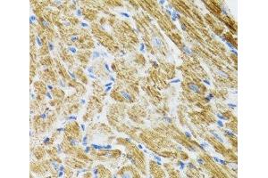 Immunohistochemistry of paraffin-embedded Rat heart using POLG2 Polyclonal Antibody at dilution of 1:100 (40x lens).