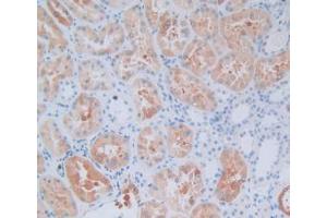 IHC-P analysis of Human Kidney Tissue, with DAB staining. (CRYAB antibody  (AA 1-175))