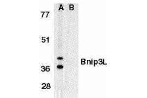 Western blot analysis of Bnip3L in K562 whole cell lysate in the absence (A), or presence (B) of immunogenic peptide with Bnip3L antibody at 1μg/ml. (BNIP3L/NIX antibody  (AA 77-92))