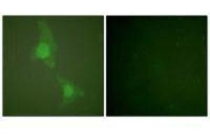 Immunofluorescence analysis of HeLa cells, using ADD1 (Ab-726) antibody (alpha Adducin antibody  (Ser726))