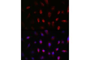 Immunofluorescence analysis of U-251MG cells using GNB3 Rabbit pAb (ABIN1680055, ABIN3015467, ABIN3015468 and ABIN6218020) at dilution of 1:50 (40x lens). (GNB3 antibody  (AA 1-230))