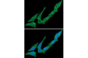 ICC/IF analysis of CD73 in HeLa cells. (CD73 antibody)