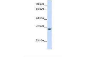 Image no. 1 for anti-Fast Skeletal Troponin T (TNNT3) (C-Term) antibody (ABIN6738755) (TNNT3 antibody  (C-Term))