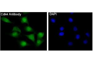 Immunofluorescent analysis of NIH/3T3 cells, using CDK4 Antibody. (Recombinant CDK4 antibody)