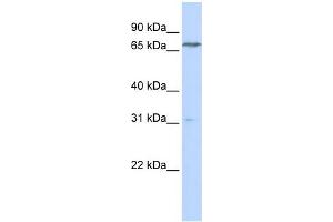 WB Suggested Anti-PCCA Antibody Titration:  0. (PCCA antibody  (N-Term))