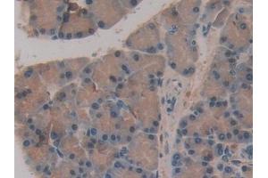 Immunohistochemistry (IHC) image for anti-Coagulation Factor XIII, A1 Polypeptide (F13A1) (AA 140-377) antibody (ABIN7440509)