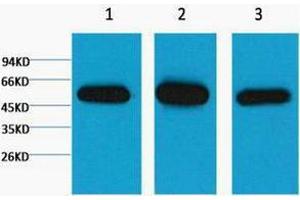 Western Blotting (WB) image for anti-Tubulin, beta 1 (TUBB1) antibody (ABIN3181109) (TUBB1 antibody)