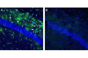 Expression of HCAR1 in mouse hippocampus.