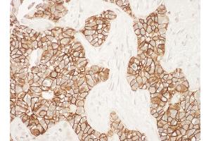 Immunohistochemistry (IHC) image for anti-Receptor tyrosine-protein kinase erbB-2 (ErbB2/Her2) (C-Term) antibody (ABIN7453854)