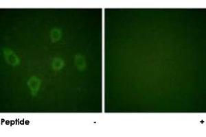 Immunofluorescence analysis of HUVEC cells, using CASP9 polyclonal antibody .