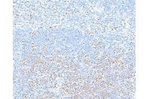 Immunohistochemistry (IHC) image for anti-Transcription Factor 7 (T-Cell Specific, HMG-Box) (TCF7) (AA 200-250) antibody (ABIN7449420) (Recombinant TCF7 antibody  (AA 200-250))