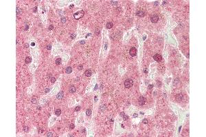 Immunohistochemistry (IHC) image for anti-Cytochrome P450, Family 3, Subfamily A, Polypeptide 4 (CYP3A4) (AA 398-447) antibody (ABIN6754944)