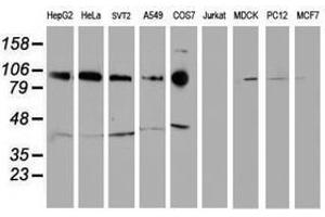 Image no. 1 for anti-Cadherin 2 (CDH2) antibody (ABIN1499626) (N-Cadherin antibody)