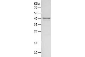 Western Blotting (WB) image for 2',5'-Oligoadenylate Synthetase 1, 40/46kDa (OAS1) (AA 1-364) protein (His tag) (ABIN7283273) (OAS1 Protein (AA 1-364) (His tag))