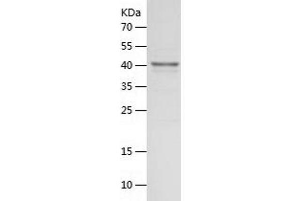 OAS1 Protein (AA 1-364) (His tag)