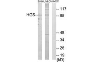 Western blot analysis of extracts from 293/HuvEc cells, using HGS Antibody. (HGS antibody  (AA 451-500))