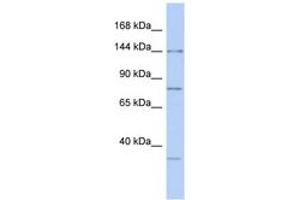 Image no. 1 for anti-Drosha, Ribonuclease Type III (DROSHA) (C-Term) antibody (ABIN6743004)