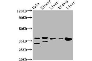 Western Blot Positive WB detected in: Hela whole cell lysate, Rat kidney tissue, Rat liver tissue, Mouse kidney tissue, Mouse liver tissue All lanes: PPA2 antibody at 3. (PPA2 antibody  (AA 180-298))