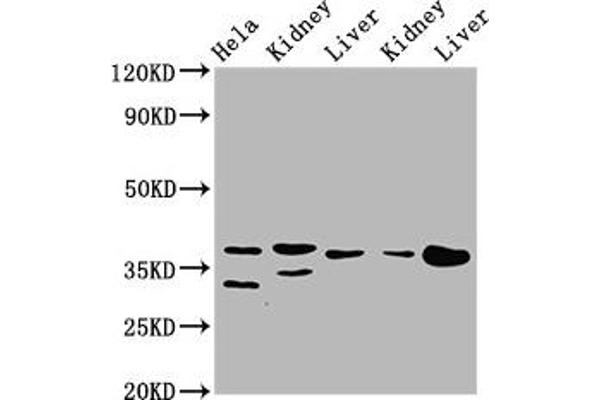 PPA2 anticorps  (AA 180-298)