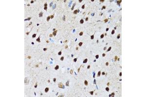 Immunohistochemistry of paraffin-embedded rat brain using CCAR2 antibody (ABIN2563550) at dilution of 1:100 (40x lens). (CCAR2 antibody)