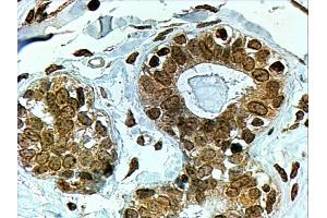 ABIN185122 (4µg/ml) staining of paraffin embedded Human Breast. (CYP7B1 antibody  (C-Term))