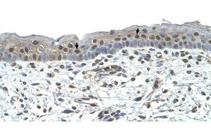 NR2C2 antibody was used for immunohistochemistry at a concentration of 4-8 ug/ml to stain Squamous epithelial cells (arrows) in Human Skin. (TR4 antibody  (C-Term))