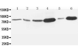 Anti-MMP9 antibody, Western blotting Lane 1: Rat Embryo Tissue Lysate Lane 2: MM453 Cell Lysate Lane 3: HELA Cell Lysate Lane 4: SMMC Cell Lysate Lane 5: JURKAT Cell Lysate Lane 6:  Cell Lysate (MMP 9 antibody  (C-Term))