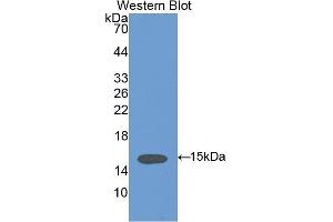 Detection of Recombinant VCL, Human using Anti-Vinculin (VCL) Polyclonal Antibody (Vinculin antibody  (AA 1020-1134))