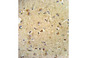 Formalin-fixed and paraffin-embedded human brain tissue reacted with OLR1 Antibody (Center), which was peroxidase-conjugated to the secondary antibody, followed by DAB staining. (OLR1 antibody  (AA 64-92))