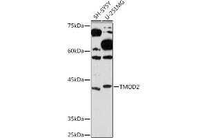 Western blot analysis of extracts of various cell lines, using TMOD2 Rabbit mAb (ABIN7271011) at 1:1000 dilution. (TMOD2 antibody)