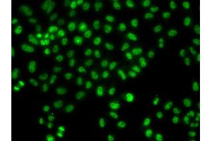 Immunofluorescence analysis of HeLa cell using LHX8 antibody.