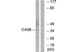 Western blot analysis of extracts from NIH-3T3 cells, using CA5B Antibody. (CA5B antibody  (AA 241-290))