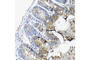 Immunohistochemistry of paraffin-embedded mouse jejunum using  antibody (ABIN6127437, ABIN6136922, ABIN6136923 and ABIN6217829) at dilution of 1:50 (40x lens). (Annexin A13 antibody  (AA 1-316))