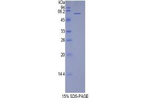 SDS-PAGE analysis of Human TERF1 Protein.