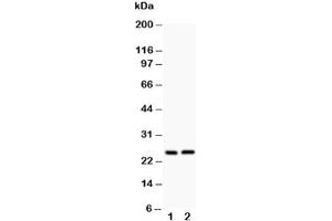 Western blot testing of Claudin 2 antibody and Lane 1:  rat kidney