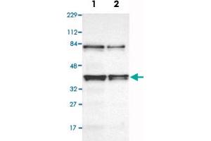 Western Blot analysis of Lane 1: RT-4 and Lane 2: U-251MG sp cell lysates with HNRNPD polyclonal antibody . (HNRNPD/AUF1 antibody)
