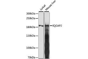 Western blot analysis of extracts of various cell lines, using IQGAP2 antibody. (IQGAP2 antibody)