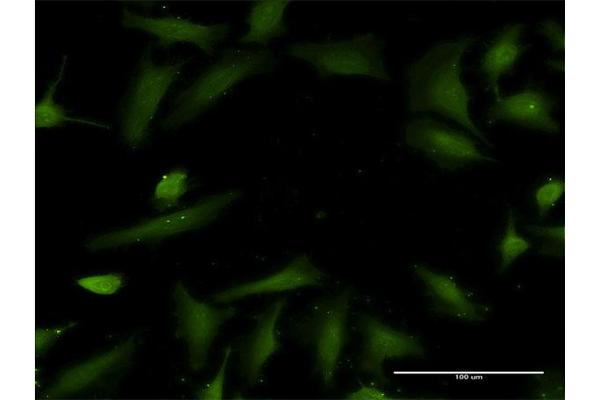 HTN3 antibody  (AA 1-51)