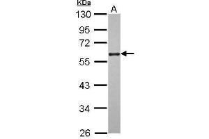 WB Image Sample (30 ug of whole cell lysate) A: A431 10% SDS PAGE antibody diluted at 1:2000