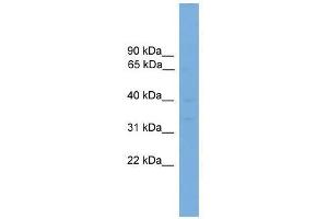 Western Blot showing PIM2 antibody used at a concentration of 1-2 ug/ml to detect its target protein. (PIM2 antibody  (Middle Region))