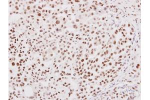Immunohistochemistry (IHC) image for anti-Nuclear Respiratory Factor 1 (NRF1) antibody (ABIN2855569)